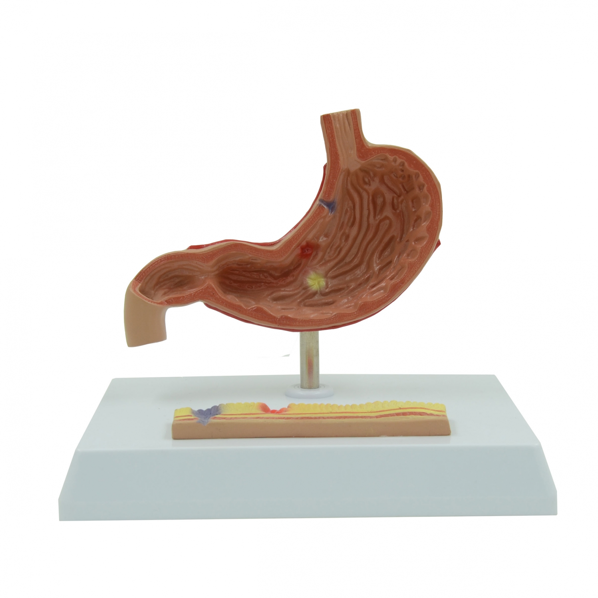 A456 Модель патологий желудка, в разрезе