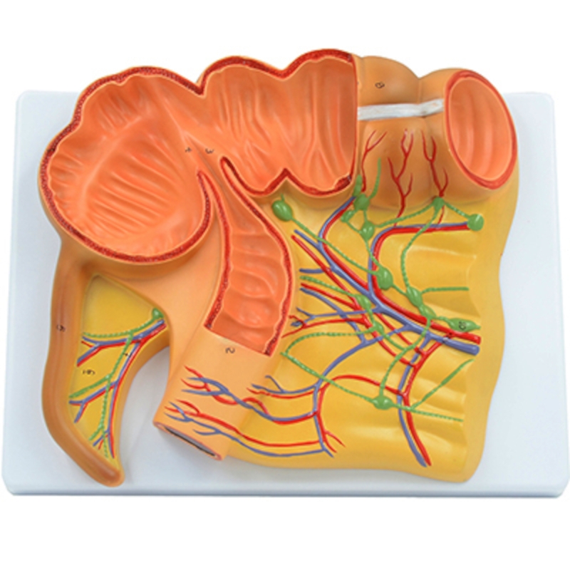 A490 Модель слепой кишки и аппендикса, ув.2х