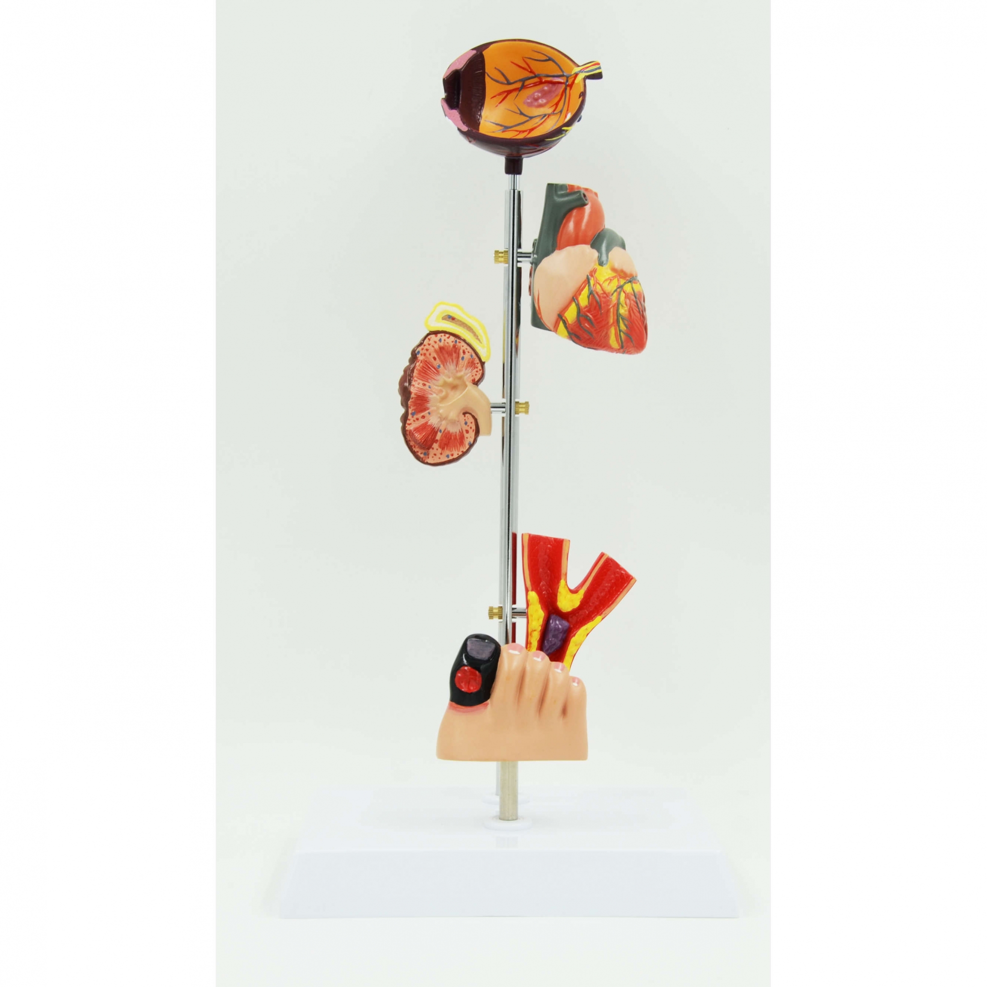 A758 Модель диабетических поражений органов человека