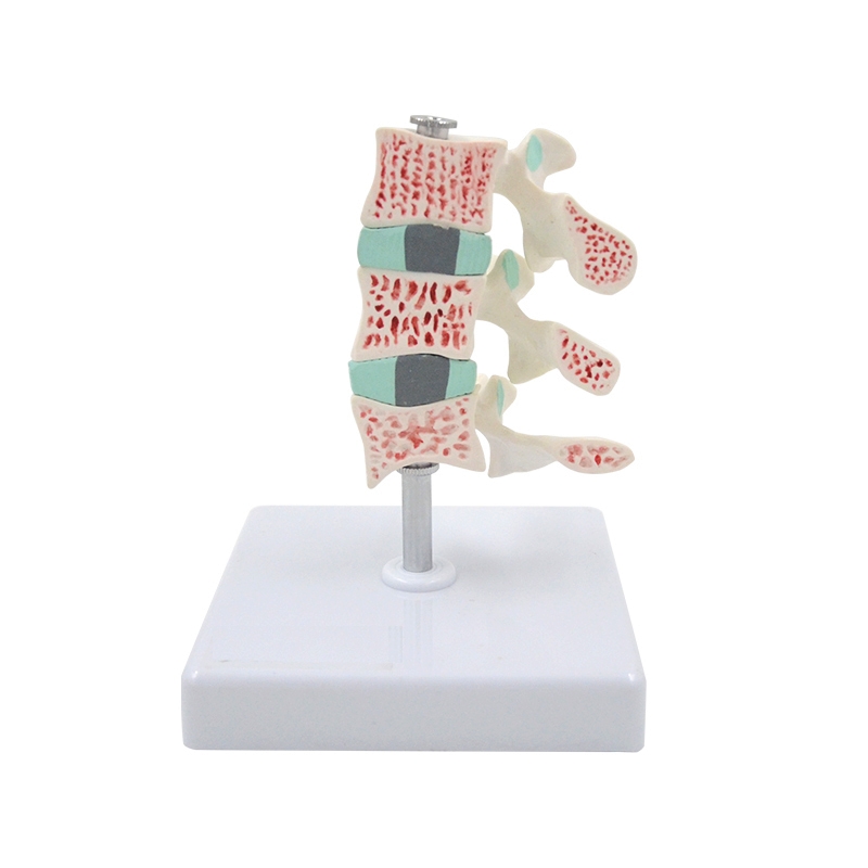 A762 Модель остеопороза