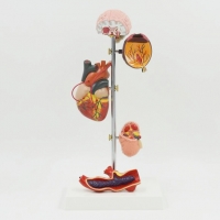 A759 Модель воздействия артериальной гипертензии